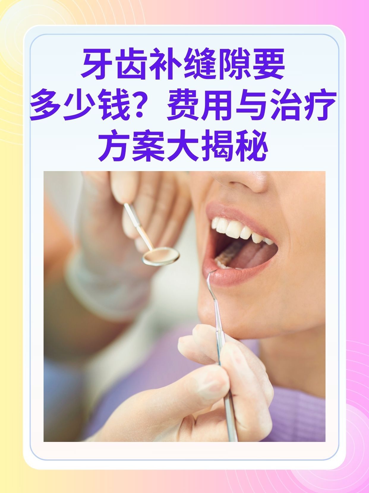 梧州补牙医保可以报销吗(补牙医保可以报销吗 哪些可以报销呢)